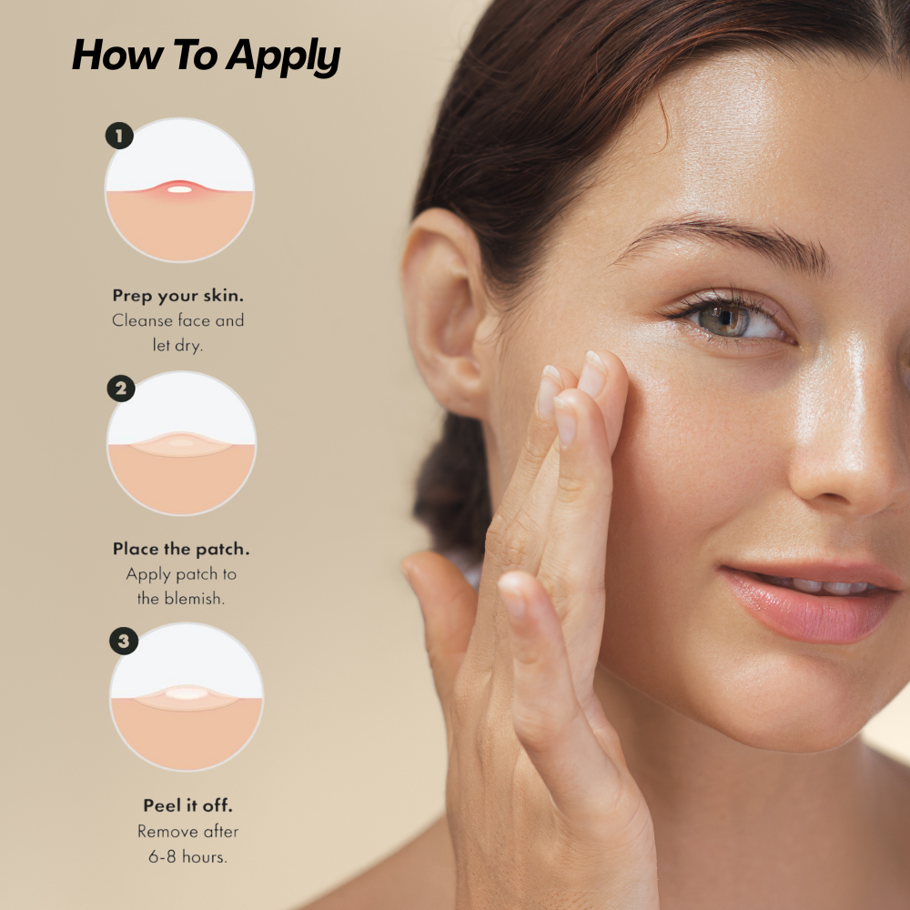Acne Patches